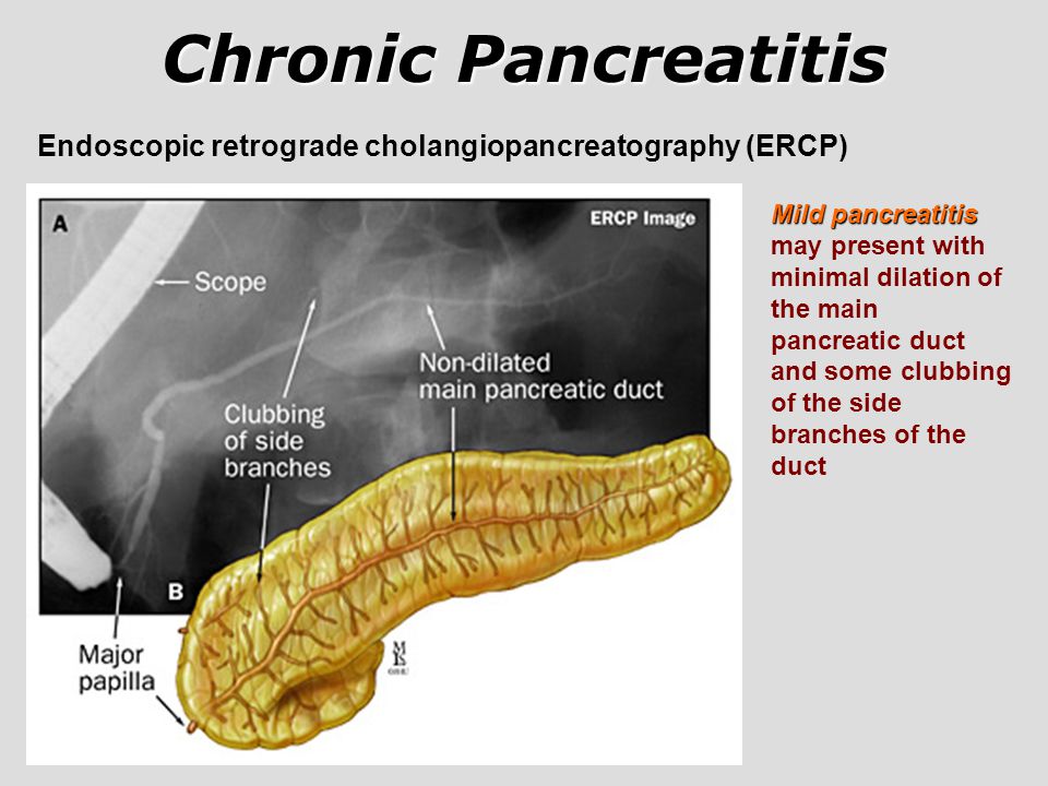 Menú para pancreatitis